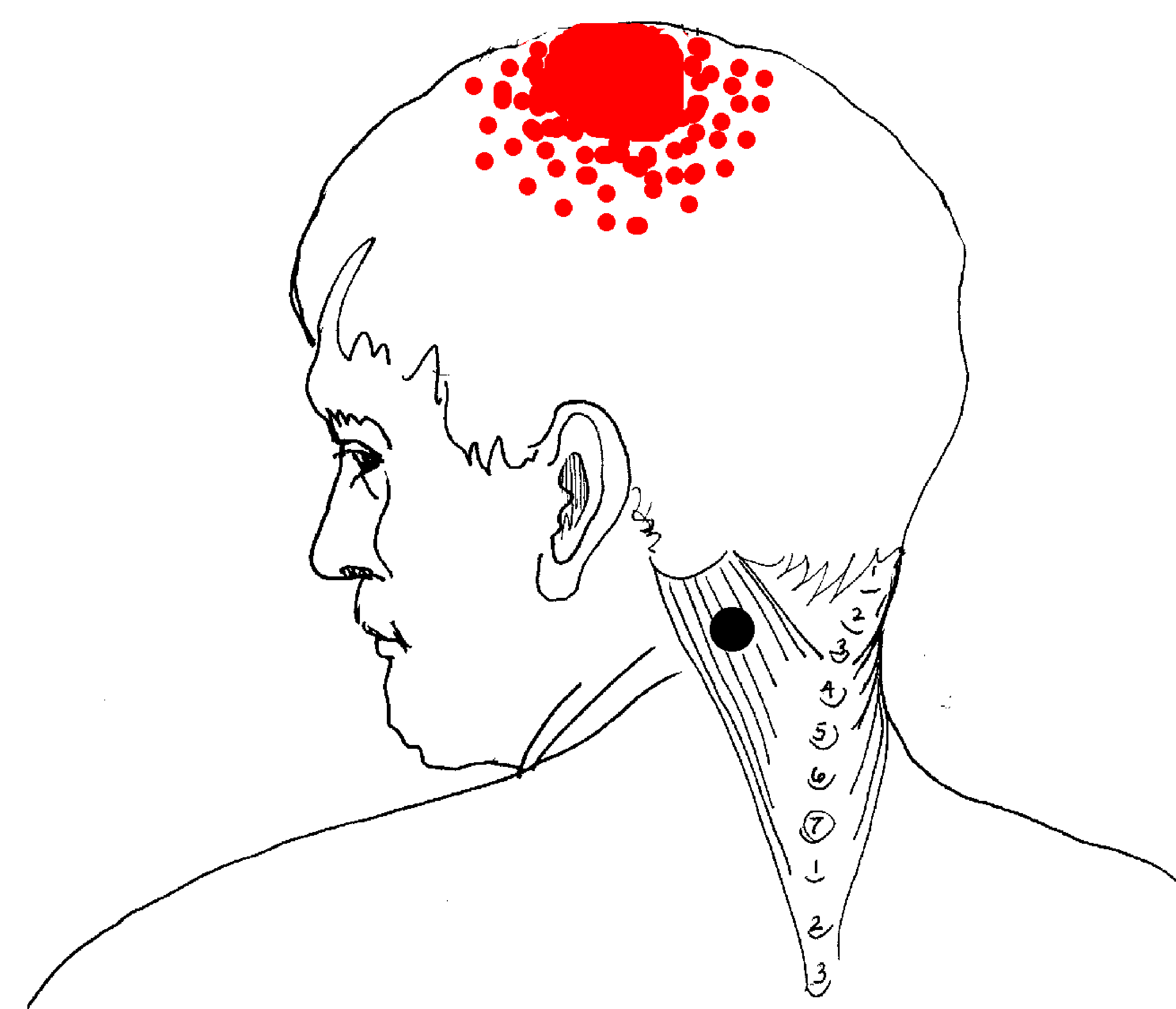 pain in head